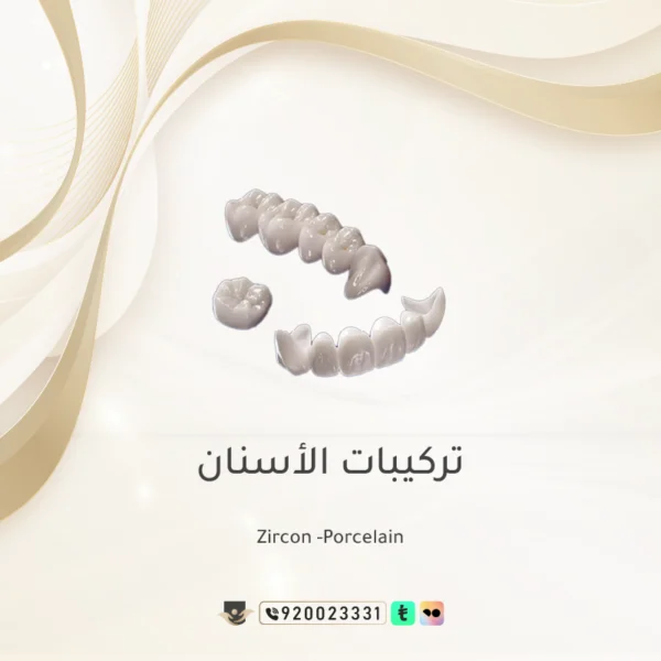 تركيبات الأسنان - لسن الواحد